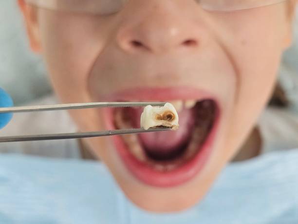 Best Pediatric Emergency Dentist in Mill Plain, CT